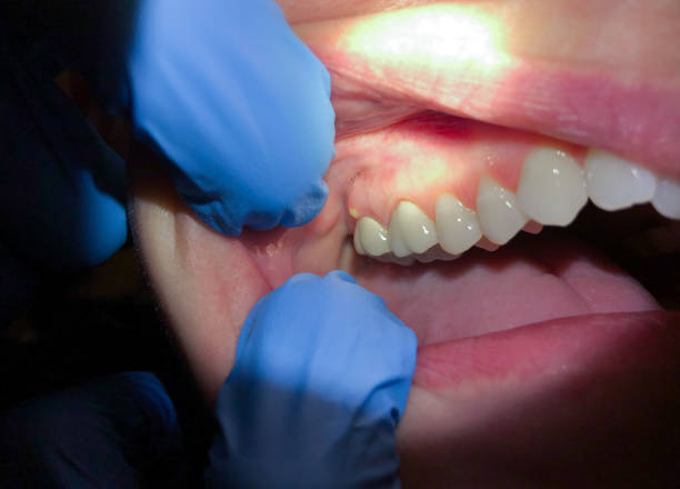 Best Emergency Dental Care for Trauma or Injury in Panhandle, TX